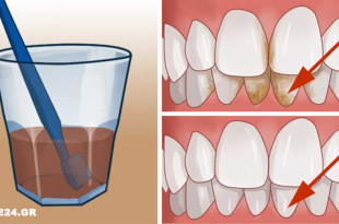 Αφαιρέστε την Πέτρα, Καθαρίστε την Πλάκα & Αντιμετωπίστε τα Βακτήρια του Στόματος με Αυτά τα Φυσικά Συστατικά