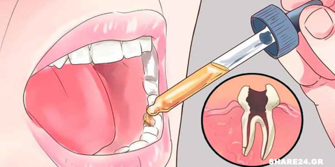 12 Γιατροσόφια για τον Πονόδοντο που δεν θα Σας Πει Ποτέ ο Οδοντίατρος