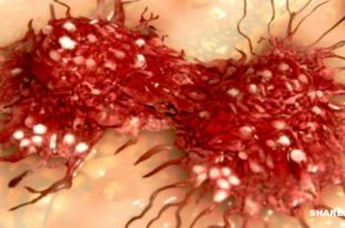 Οι Επιστήμονες Απέδειξαν ότι η Εμπάθεια Σχετίζεται Άμεσα με την Εμφάνιση Καρκίνου