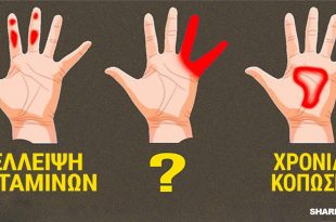 Τα Χέρια μπορούν να Προειδοποιήσουν για αυτά τα 7 Συμπτώματα Υγείας! Κόπωση, Ανεπάρκεια Βιταμινών και Διαβήτης